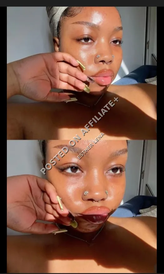 Clear Skin &Acene free Guide 2